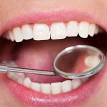 Close up of dental mirror inspecting a patient’s smile