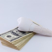 Large model dental implant on top of stack of money