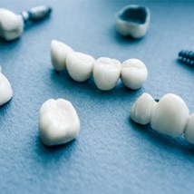Several types of dental implants in Tomball on blue background