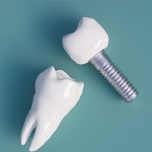 Model implant and model tooth laying on a blue background  