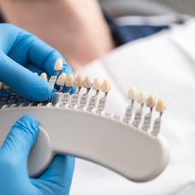 dentist matching the color of a patient’s tooth