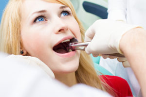 Young woman having wisdom tooth extracted