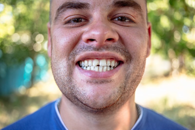 man smiling with chipped tooth