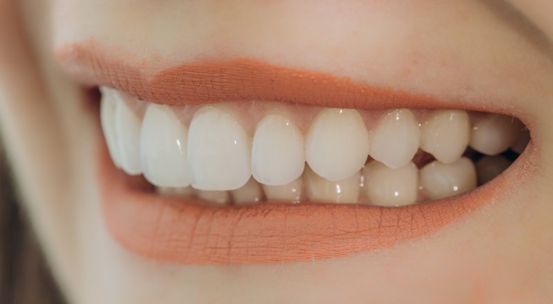 Woman with porcelain veneers in Tomball